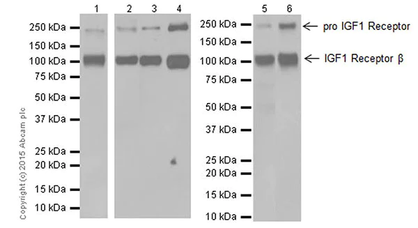 Western blot - Anti-IGF1 Receptor antibody [EPR19322] (AB182408)