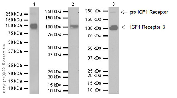 Western blot - Anti-IGF1 Receptor antibody [EPR19322] (ab182408), expandable thumbnail