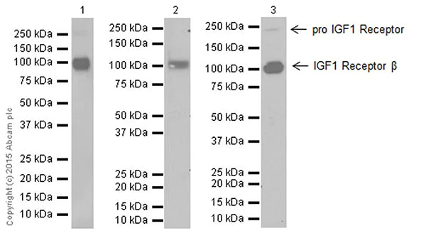 Western blot - Anti-IGF1 Receptor antibody [EPR19322] (AB182408)