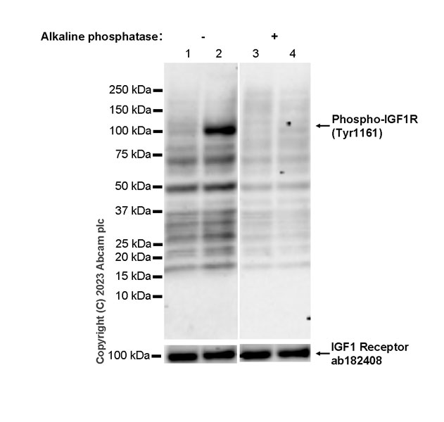 Western blot - Anti-IGF1 Receptor antibody [EPR19322] (ab182408), expandable thumbnail