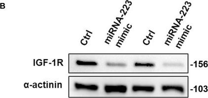 Western blot - Anti-IGF1 Receptor antibody [EPR19322] (ab182408), expandable thumbnail