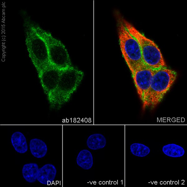 Immunocytochemistry/ Immunofluorescence - Anti-IGF1 Receptor antibody [EPR19322] - Low endotoxin, Azide free (AB246702), expandable thumbnail