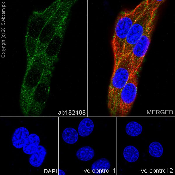 Immunocytochemistry/ Immunofluorescence - Anti-IGF1 Receptor antibody [EPR19322] - Low endotoxin, Azide free (AB246702), expandable thumbnail