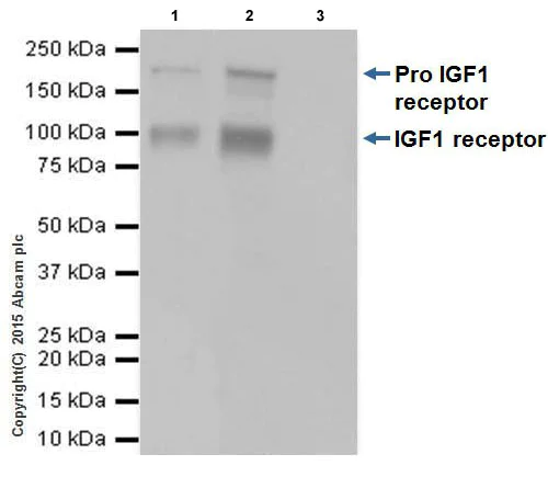Immunoprecipitation - Anti-IGF1 Receptor antibody [EPR19322] - Low endotoxin, Azide free (AB246702)
