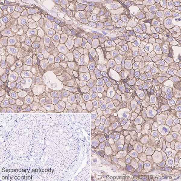 Immunohistochemistry (Formalin/PFA-fixed paraffin-embedded sections) - Anti-IGF1 Receptor antibody [EPR23027-204] (AB263903), expandable thumbnail