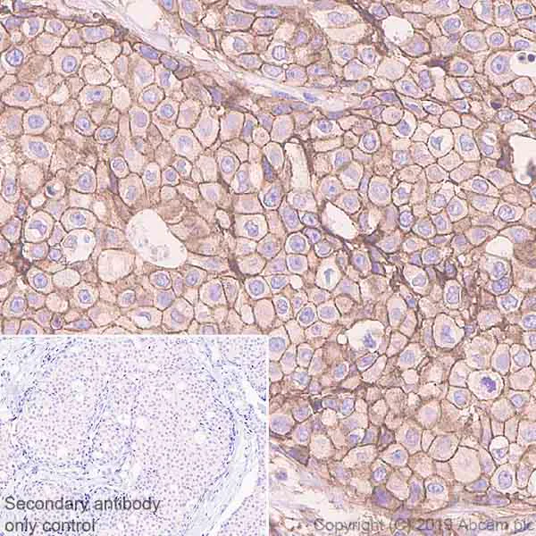 Immunohistochemistry (Formalin/PFA-fixed paraffin-embedded sections) - Anti-IGF1 Receptor antibody [EPR23027-204] (AB263903)