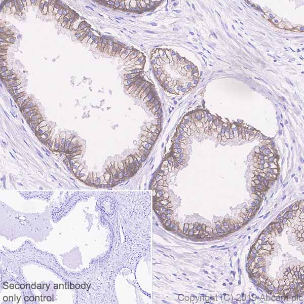 Immunohistochemistry (Formalin/PFA-fixed paraffin-embedded sections) - Anti-IGF1 Receptor antibody [EPR23027-204] (AB263903), expandable thumbnail