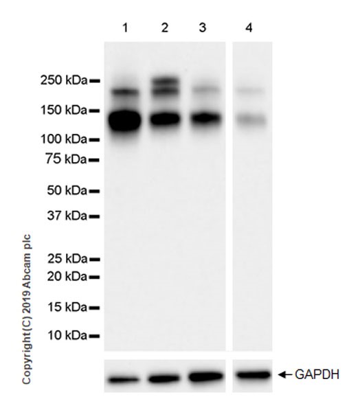 Western blot - Anti-IGF1 Receptor antibody [EPR23027-204] (AB263903), expandable thumbnail