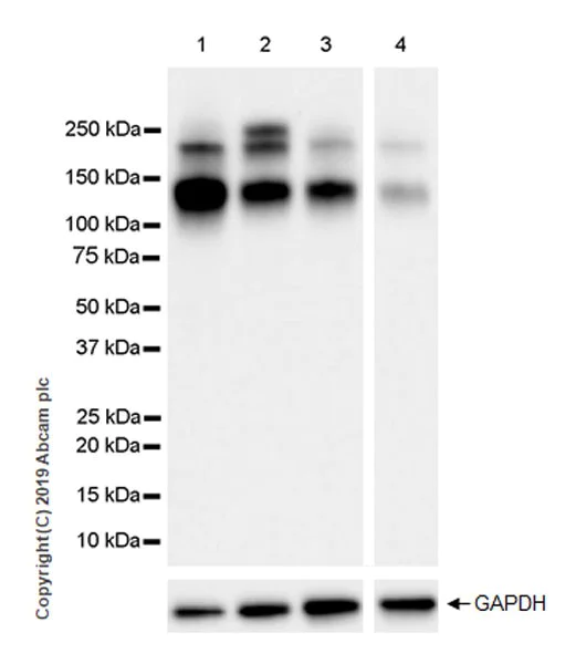 Western blot - Anti-IGF1 Receptor antibody [EPR23027-204] (AB263903)