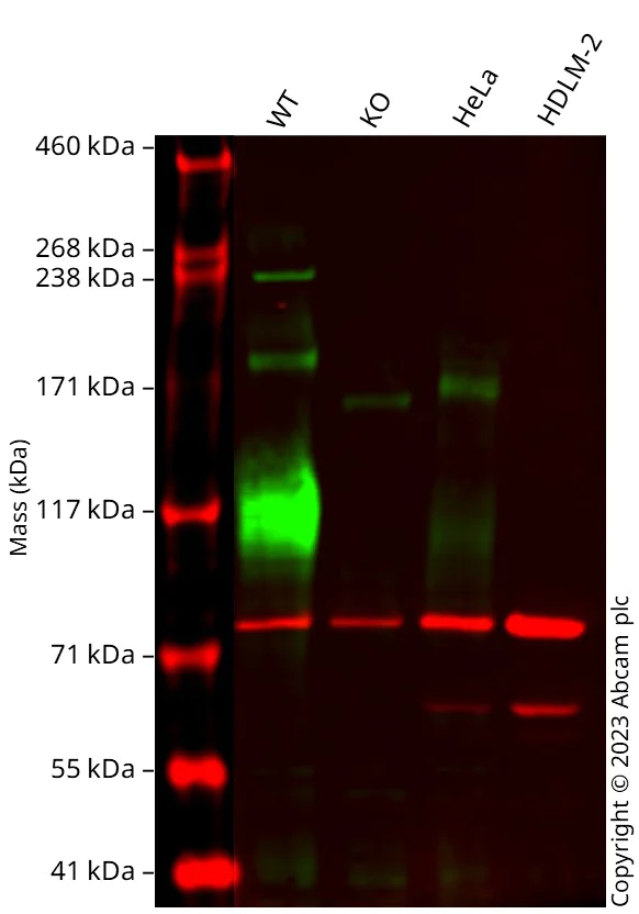 Western blot - Anti-IGF1 Receptor antibody [EPR23027-80] (AB263907)