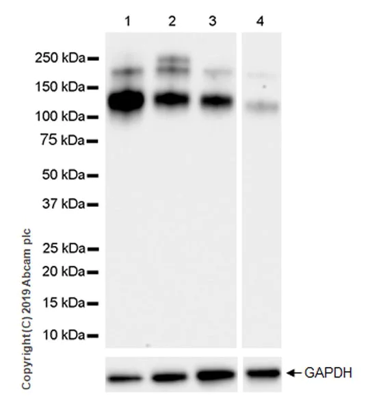 Western blot - Anti-IGF1 Receptor antibody [EPR23027-80] (AB263907)
