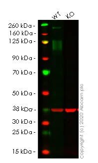 Western blot - Anti-IGF1 Receptor antibody [EPR23027-80] - BSA and Azide free (AB267344)