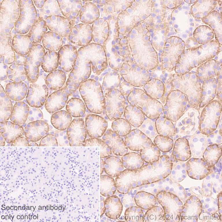 Immunohistochemistry (Formalin/PFA-fixed paraffin-embedded sections) - Anti-IGF1 Receptor antibody [EPR27277-5] (AB322659)