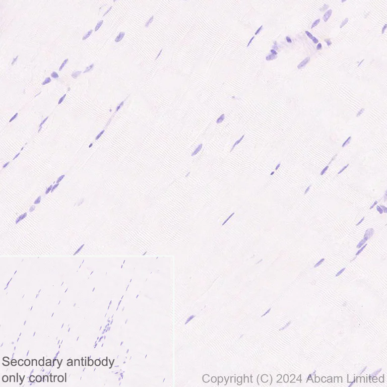 Immunohistochemistry (Formalin/PFA-fixed paraffin-embedded sections) - Anti-IGF1 Receptor antibody [EPR27277-5] (AB322659)