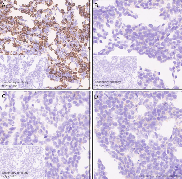 Immunohistochemistry (Formalin/PFA-fixed paraffin-embedded sections) - Anti-IGF1 Receptor antibody [EPR27277-5] (AB322659)