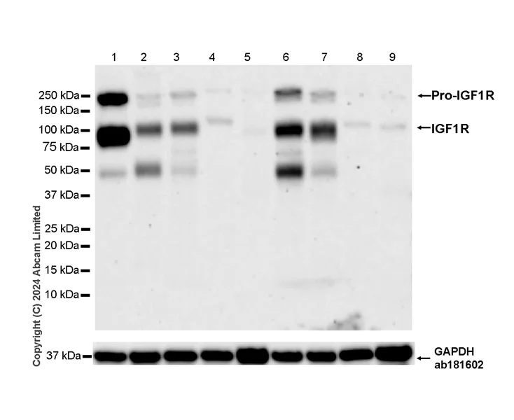 Western blot - Anti-IGF1 Receptor antibody [EPR27277-5] (AB322659)