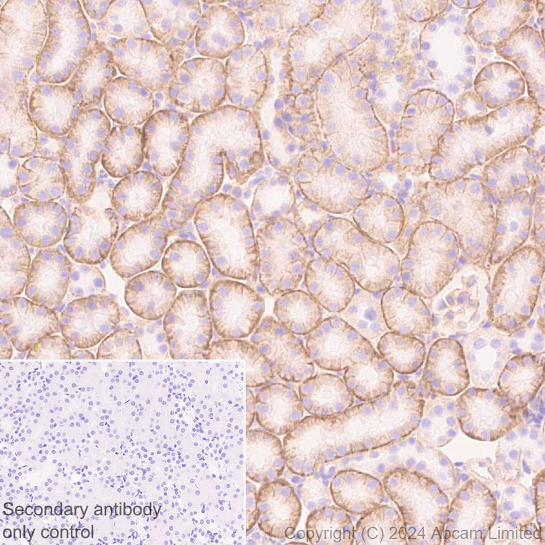 Immunohistochemistry (Formalin/PFA-fixed paraffin-embedded sections) - Anti-IGF1 Receptor antibody [EPR27277-5] - BSA and Azide free (AB325951)