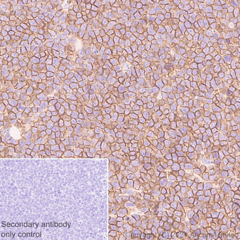Immunohistochemistry (Formalin/PFA-fixed paraffin-embedded sections) - Anti-IGF1 Receptor antibody [EPR27277-5] - BSA and Azide free (AB325951)