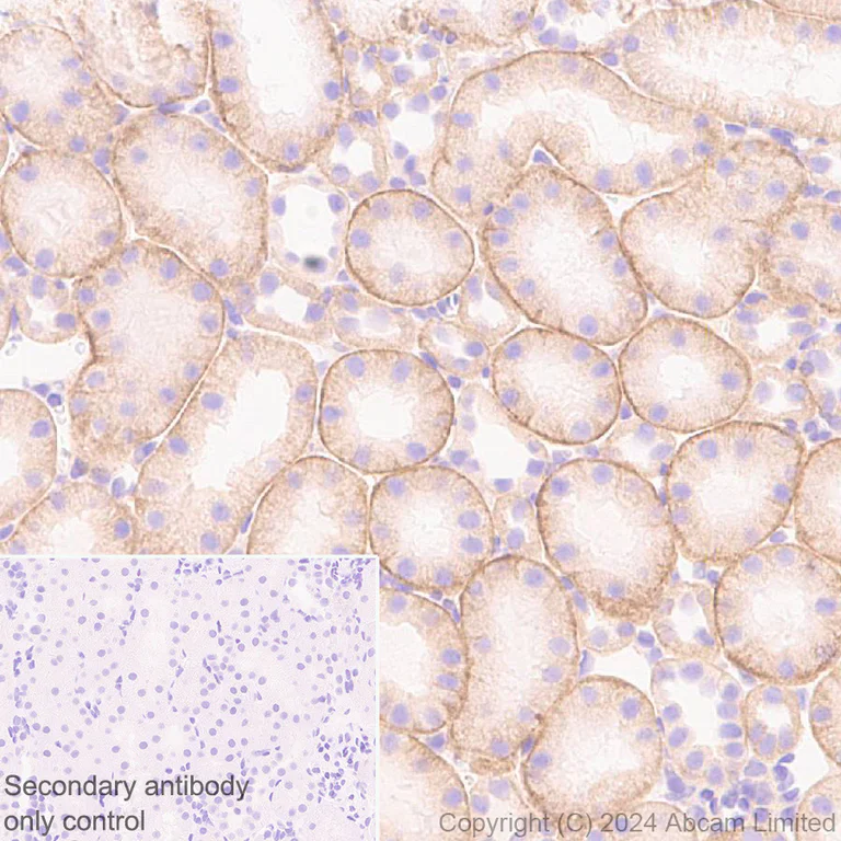 Immunohistochemistry (Formalin/PFA-fixed paraffin-embedded sections) - Anti-IGF1 Receptor antibody [EPR27277-5] - BSA and Azide free (AB325951)