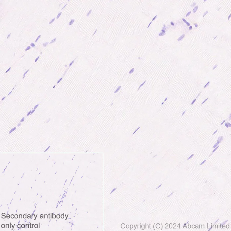 Immunohistochemistry (Formalin/PFA-fixed paraffin-embedded sections) - Anti-IGF1 Receptor antibody [EPR27277-5] - BSA and Azide free (AB325951)