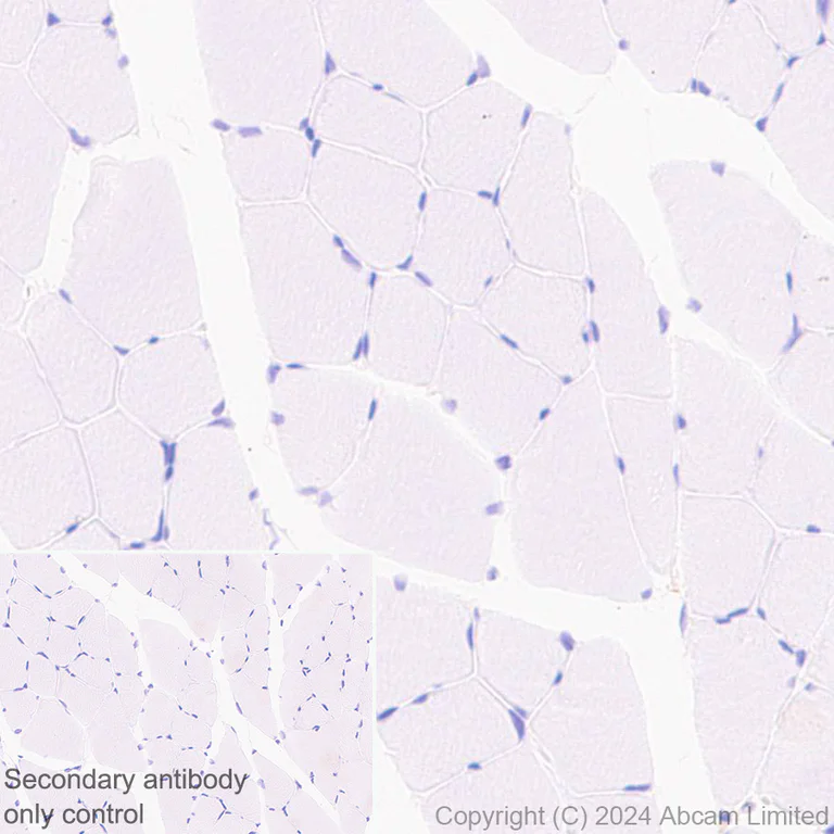 Immunohistochemistry (Formalin/PFA-fixed paraffin-embedded sections) - Anti-IGF1 Receptor antibody [EPR27277-5] - BSA and Azide free (AB325951)