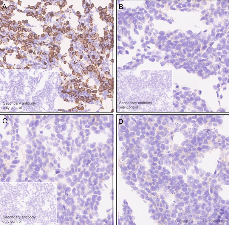 Immunohistochemistry (Formalin/PFA-fixed paraffin-embedded sections) - Anti-IGF1 Receptor antibody [EPR27277-5] - BSA and Azide free (AB325951)