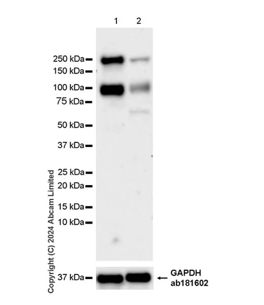 Western blot - Anti-IGF1 Receptor antibody [EPR27277-5] - BSA and Azide free (AB325951)