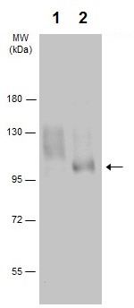 Western blot - Anti-IGF1 Receptor (phospho Y1131) antibody (AB226915), expandable thumbnail