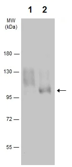 Western blot - Anti-IGF1 Receptor (phospho Y1131) antibody (AB226915)