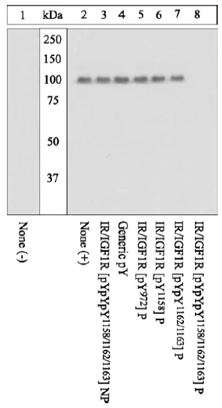 Western blot - Anti-IGF1 Receptor (phospho Y1131+ Y1135+ Y1136) + INSR (phospho Y1158+ Y1162+ Y1163) antibody (AB5681)