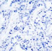 Immunohistochemistry (Formalin/PFA-fixed paraffin-embedded sections) - Anti-IGF1 Receptor (phospho Y1161) antibody (AB39398)