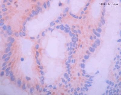 Immunohistochemistry (Formalin/PFA-fixed paraffin-embedded sections) - Anti-IGF1 Receptor (phospho Y1161) antibody (AB39398), expandable thumbnail