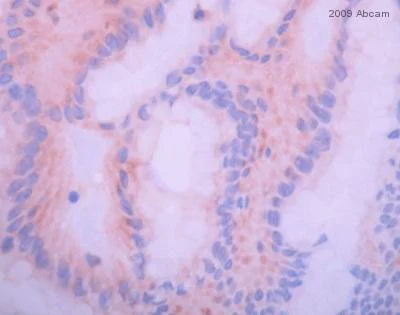 Immunohistochemistry (Formalin/PFA-fixed paraffin-embedded sections) - Anti-IGF1 Receptor (phospho Y1161) antibody (AB39398)