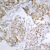 Immunohistochemistry (Formalin/PFA-fixed paraffin-embedded sections) - Anti-IGF1 Receptor (phospho Y1161) antibody (AB39398), expandable thumbnail