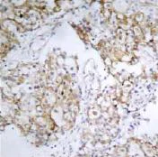 Immunohistochemistry (Formalin/PFA-fixed paraffin-embedded sections) - Anti-IGF1 Receptor (phospho Y1161) antibody (AB39398)