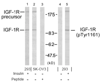 Western blot - Anti-IGF1 Receptor (phospho Y1161) antibody (AB39398)