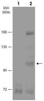 Western blot - Anti-IGF1 Receptor (phospho Y1316) antibody (AB226871), expandable thumbnail