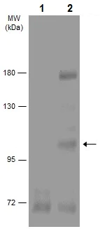 Western blot - Anti-IGF1 Receptor (phospho Y1316) antibody (AB226871)