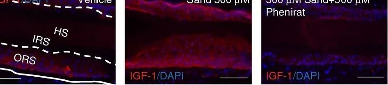 Immunohistochemistry - Anti-IGF1+IGF2 antibody (AB9572)