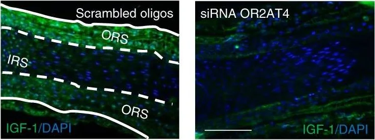 Immunohistochemistry - Anti-IGF1+IGF2 antibody (AB9572)