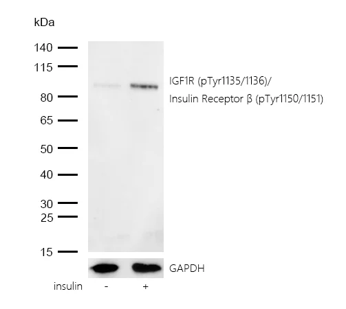 Western blot - Anti-IGF1R (phospho Y1135 + Y1136) + INSR (phospho Y1150 + Y1151) antibody [SR4355] (AB326679)