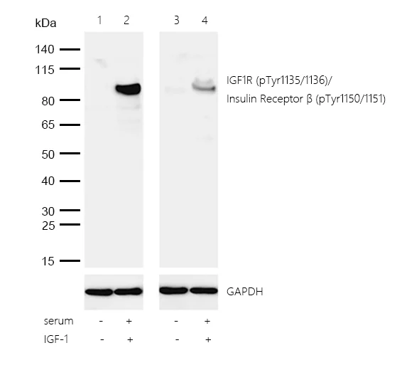 Western blot - Anti-IGF1R (phospho Y1135 + Y1136) + INSR (phospho Y1150 + Y1151) antibody [SR4355] (AB326679)