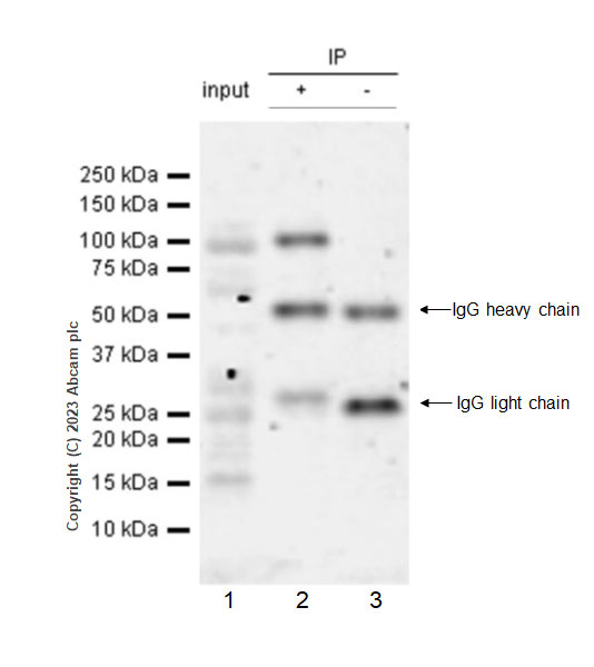 Immunoprecipitation - Anti-IGF1R (pY1161) + INSR (pY1185) + INSRR (pY1141) antibody [EPR26123-29] - BSA and Azide free (AB314117)