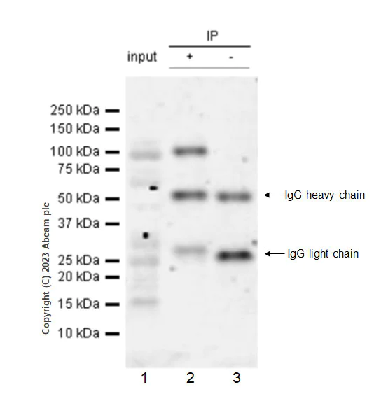 Immunoprecipitation - Anti-IGF1R (pY1161) + INSR (pY1185) + INSRR (pY1141) antibody [EPR26123-29] - BSA and Azide free (AB314117)