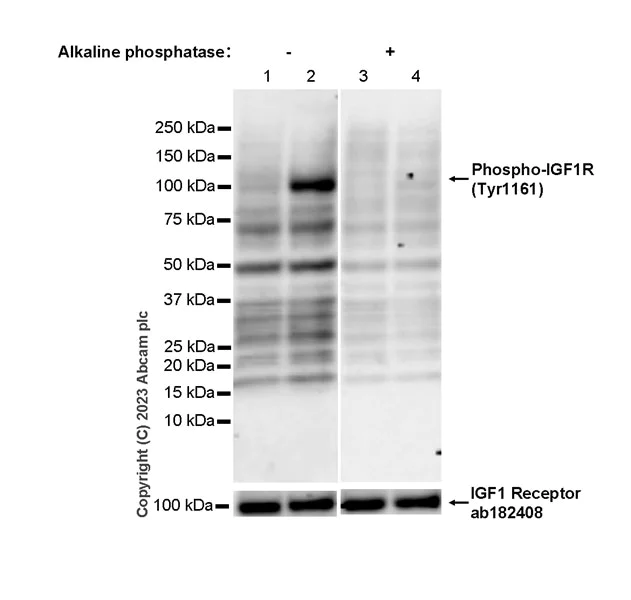 Western blot - Anti-IGF1R (pY1161) + INSR (pY1185) + INSRR (pY1141) antibody [EPR26123-29] - BSA and Azide free (AB314117)