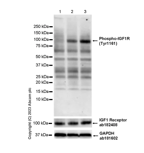 Western blot - Anti-IGF1R (pY1161) + INSR (pY1185) + INSRR (pY1141) antibody [EPR26123-29] - BSA and Azide free (AB314117)