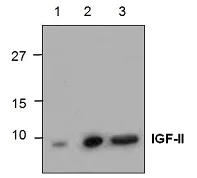 Western blot - Anti-IGF2 antibody (AB18954)