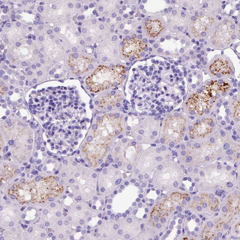 Immunohistochemistry (Formalin/PFA-fixed paraffin-embedded sections) - Anti-IGF2 antibody (AB262911)