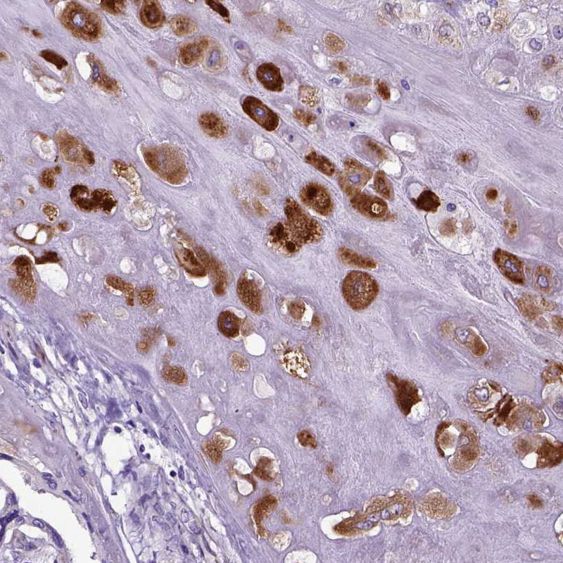 Immunohistochemistry (Formalin/PFA-fixed paraffin-embedded sections) - Anti-IGF2 antibody (AB262911)