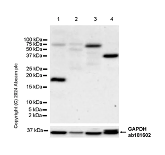 Western blot - Anti-IGF2 antibody [EPR25955-88] - BSA and Azide free (AB317491)